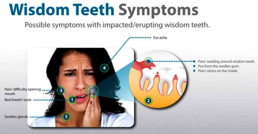 Symptoms of an Infected or Inflamed Impacted Tooth